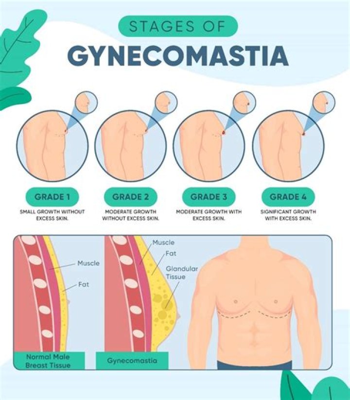 Unveiling "The Rock's" Gynecomastia Journey: Discoveries And Insights